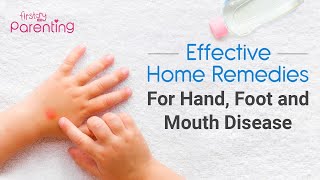 8 Effective Home Remedies for Hand Foot and Mouth Disease in Children [upl. by Nahsar]