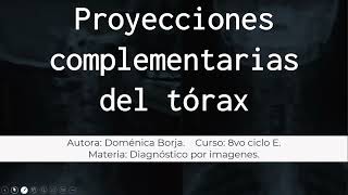 Proyecciones complementarias del torax [upl. by Neyu]