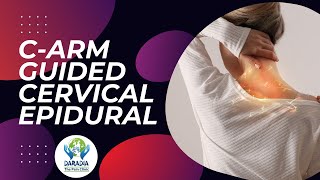 Mastering CArm Guided Cervical Epidural for Radicular Pain  StepbyStep Guide for Pain Physicians [upl. by Homere]