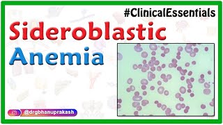 Sideroblastic Anemia  Causes Pathogenesis Clinical Presentation Diagnosis Treatment [upl. by Rebecka]