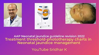 Phototherapy charts in treatment of neonatal jaundice jaundice phototherapy [upl. by Akili]