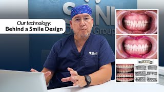 Smile Design Mexico The Path to a Hollywood Smile  Sani Dental Group [upl. by Gere]