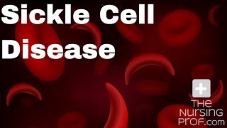 Sickle Cell Disease and Sickle Cell Crisis [upl. by Esinev]