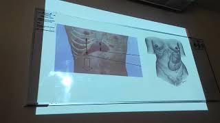 Clase 29  Semiología gastrointestinal Parte V  Patologías gastrointestinales Parte I [upl. by Larcher]