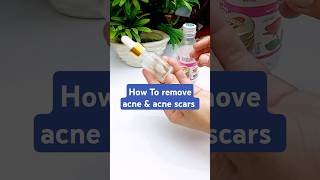 How to use tea tree oil on acne acne scarsskincare shorts [upl. by Vins646]