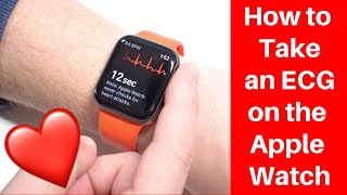 How to take an ECG on the Apple Watch [upl. by Doble]