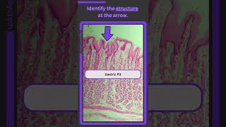 Histology Digestive System Q11 [upl. by Ahsatniuq]