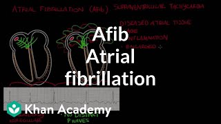 Atrial fibrillation Afib  Circulatory System and Disease  NCLEXRN  Khan Academy [upl. by Eile441]