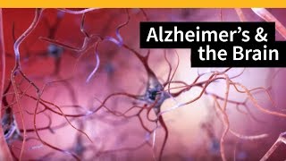 How Alzheimers Changes the Brain [upl. by Noyerb268]