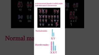 Klinefilter syndrome  Symptoms chromosomal disorderXXY male chromosomes shorts klinefelter [upl. by Ronyam]