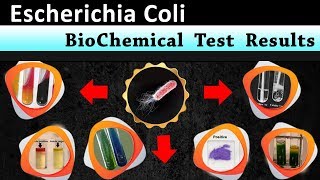 Escherichia coli Biochemical test results [upl. by Aekahs]