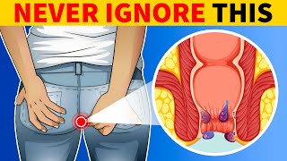 6 Signs of Colon Cancer You Should Know [upl. by Marilee]