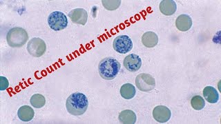 Reticulocyte  Reticulocyte count test in hindi [upl. by Chubb]