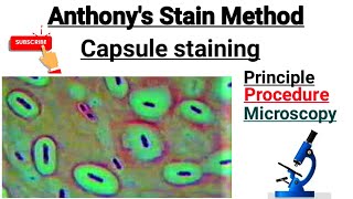 Capsule staining procedure  Anthonys stain Method part 7 [upl. by Amaso]