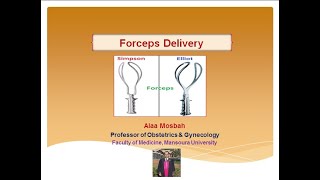 Forceps Delivery [upl. by Eiramac]