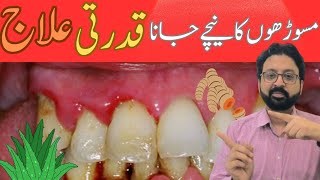 Top 2 Remedies to Cure Gum Recession at Home [upl. by Akirdnuhs]