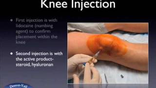 Knee injection web [upl. by Stier]