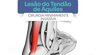 Lesão do tendão de Aquiles  Cirurgia minimamente invasiva [upl. by Giamo]