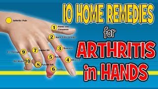 10 Home Remedies for Arthritis in Hands  Pain Relief Diet [upl. by Annaohj]