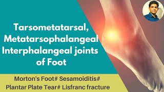 TARSOMETATARSAL  MTP  IP JOINTS OF FOOT COMPLEX Mortons foot Lisfranc fractureAnkle Series 4 [upl. by Hephzipah]