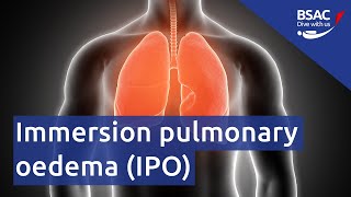 Immersion pulmonary oedema IPO  Webinar [upl. by Ethban93]