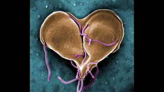 Infectious Disease InfoVid  Giardia [upl. by Biegel]