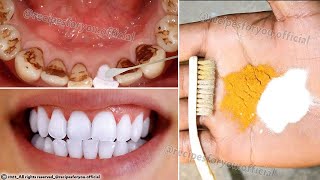 Secret that Dentists dont want you to know Remove Tartar and Teeth Whitening in just 2 minutes [upl. by Ahsel]