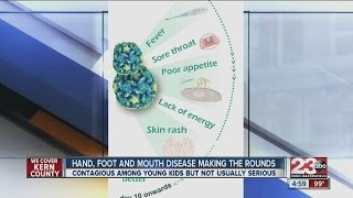 Hand foot amp mouth disease scares local parents [upl. by Ennairb]