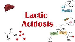 Lactic Acidosis What is it Causes ex metformin and Subtypes A vs B [upl. by Ignacio]