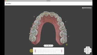 ArchForm Aligner Design Software [upl. by Neville]