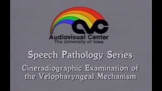 Cineradiographic Examination of the Velopharyngeal Mechanism [upl. by Rocray219]