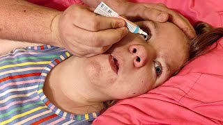 Getting Antibiotic Ointment after Eye Surgery [upl. by Fauch349]