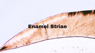 Enamel Striae  Incremental lines of retzius  Dentistry Oral Histology 🔬 [upl. by Sherrer243]