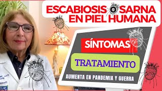 ESCABIOSIS o SARNA en PIEL HUMANA SÍNTOMAS TRATAMIENTO AUMENTA en PANDEMIA y GUERRA depielapiel [upl. by Eiveneg]