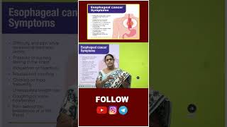 II STAFF NURSE II MEDICAL SURGICAL NURSING II ESOPHAGEAL CANCER SYMPTOMS II JYOTHI MADAM II [upl. by Reifinnej510]