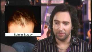 Musician Jerry Lopez Bosley Hair Transplant Testimonial [upl. by Ignatzia]