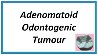 Adenomatoid Odontogenic Tumour  Important notes  Odontogenic Tumors 1  Oral Pathology [upl. by Nahseez834]