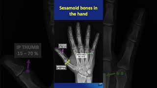 Shorts  57 Sesamoid bones in the hand  Location function and significance in less than a minute [upl. by Tenney]