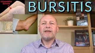 Bursitis in a Nutshell Get it better quickly [upl. by Bunker]