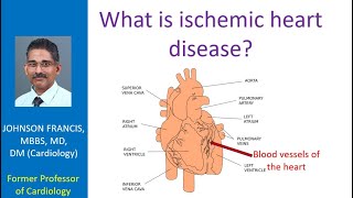 What is ischemic heart disease [upl. by Acissey]