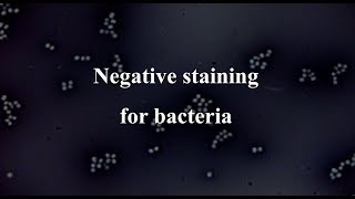 Negative staining for bacteria [upl. by Ednalrim685]