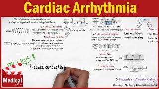 Pharmacology CVS 13 Cardiac Arrhythmia Mechanisms and Types MADE EASY [upl. by Stets]