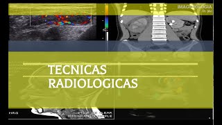 Técnicas Radiológicas Tórax [upl. by Rowell]