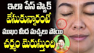 ఈ పేస్ ప్యాక్ తో మచ్చలన్నీ పోతాయి  Pigmentation Treatment at Home  Face Pack For Pigmentation [upl. by Rubina]