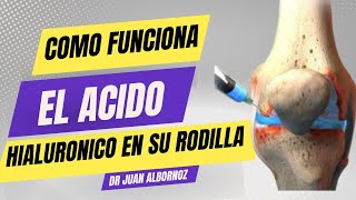 QUÃ‰ HACE EL ÃCIDO HIALURÃ“NICO EN SU RODILLA doctorjuancarlosalbornoz artrosisderodilla [upl. by Croft]