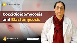 Coccidioidomycosis and Blastomycosis  Internal Medicine Infectious Disease  VLearning [upl. by Eanehs69]