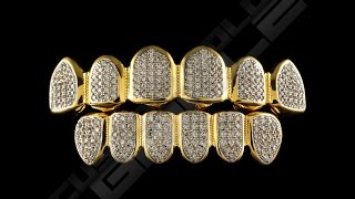 Custom Gold Grillz Iced Out Diamond Teeth Grillz [upl. by Achorn]