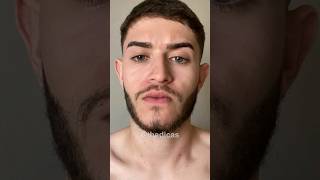 EVOLUÇÃO MINOXIDIL 6 meses de uso barba minoxidil [upl. by Sell167]