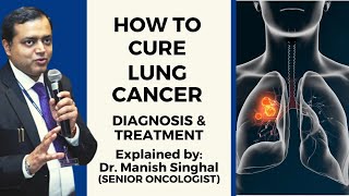 How to Cure Lung Cancer  Lung Cancer Treatment  Explained by Dr Manish Singhal [upl. by Nyliac]