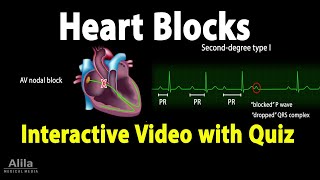 Heart AV Blocks  INTERACTIVE Animation with Quiz [upl. by Brandais]